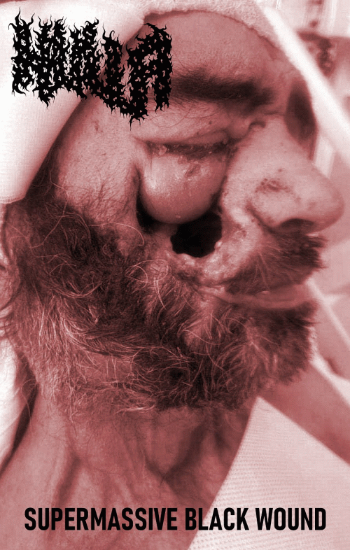 Supermassive Black Wound